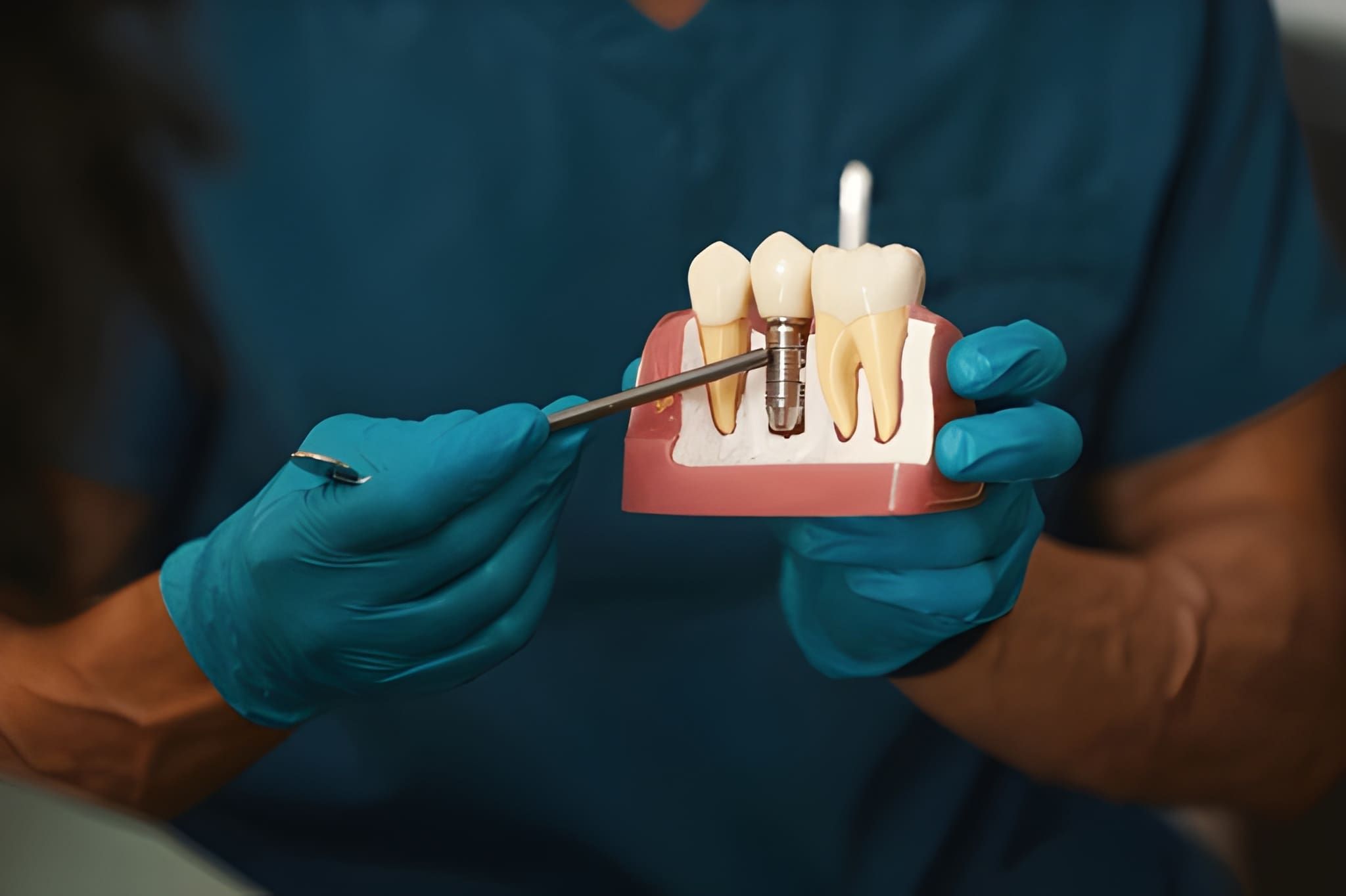 dental implants in midtown toronto, on